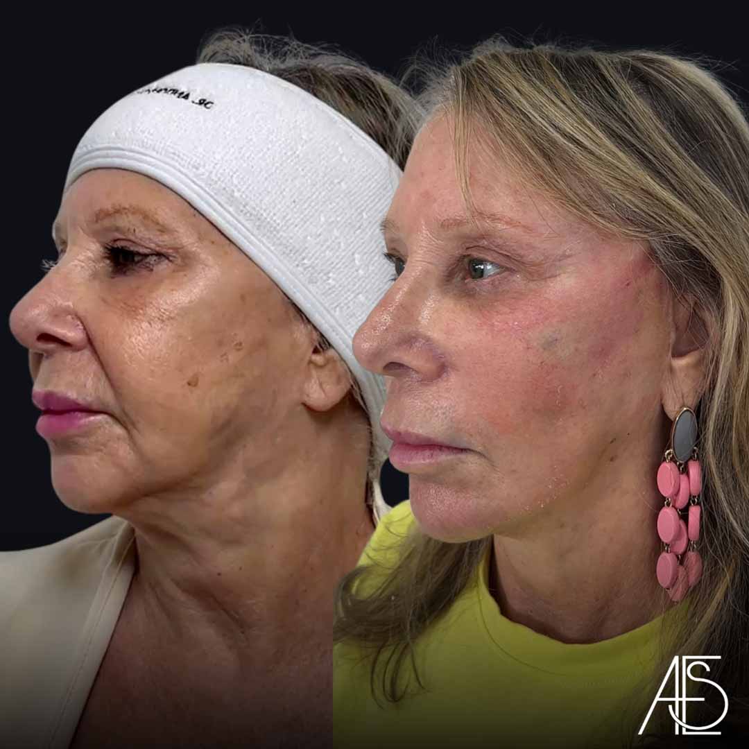 Dr. Anderson ES (11)