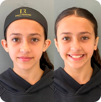 Preenchimento generativo