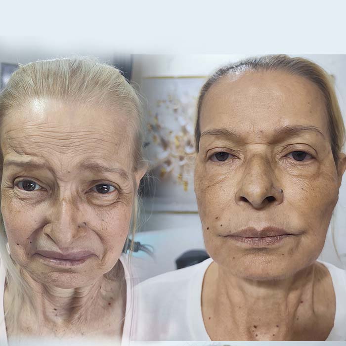 anderson_funari_ resultado2