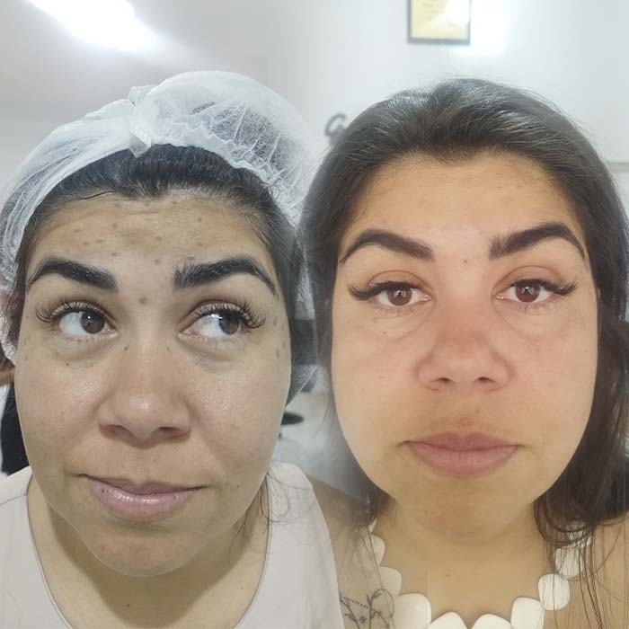 anderson_funari_ resultado3