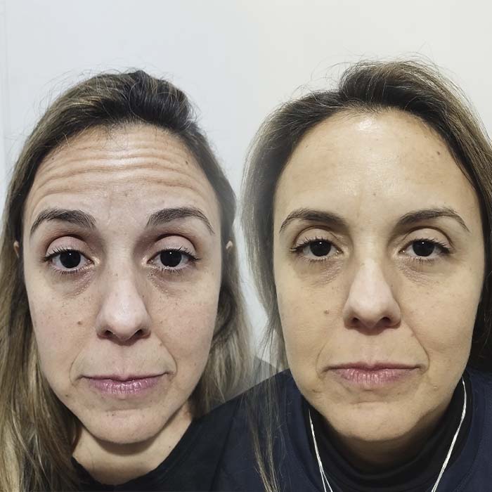 anderson_funari_ resultado4