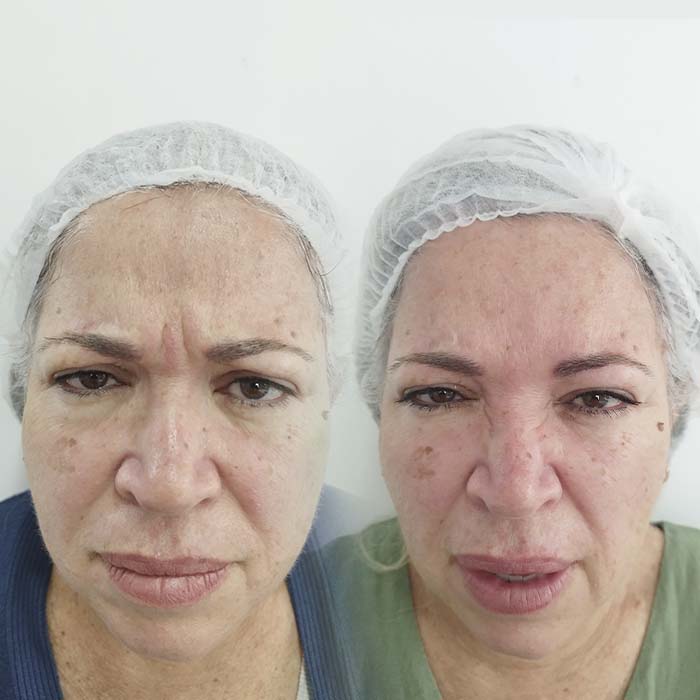 anderson_funari_ resultado5