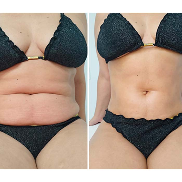 anderson_funari_ resultado6