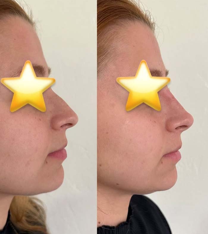 Patricia silva antes e depois (1)