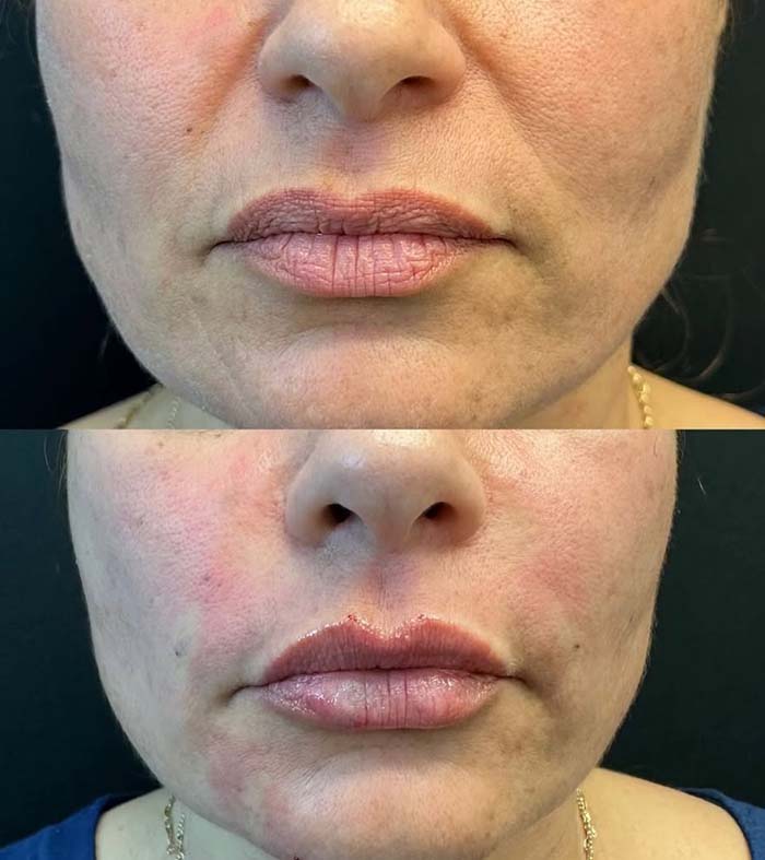 Patricia silva antes e depois (2)