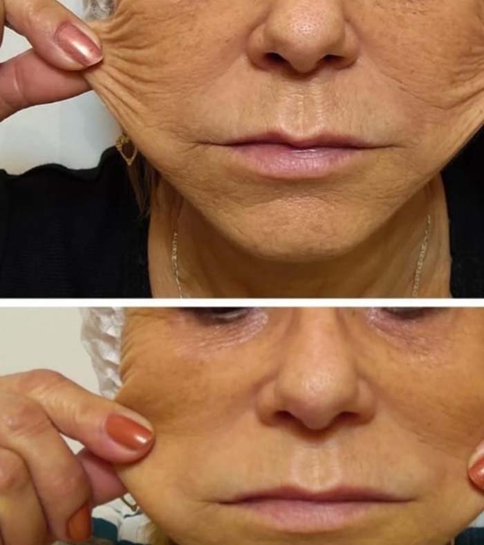 Patricia silva antes e depois (3)