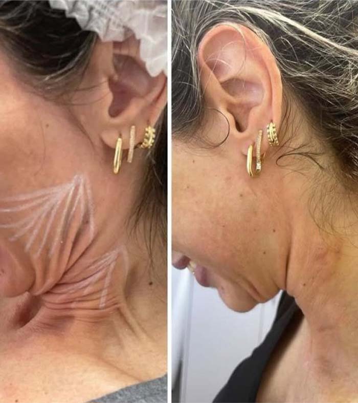 Patricia silva antes e depois (4)