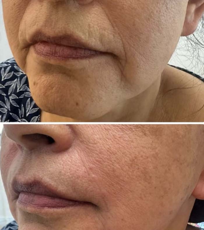 Patricia silva antes e depois (5)