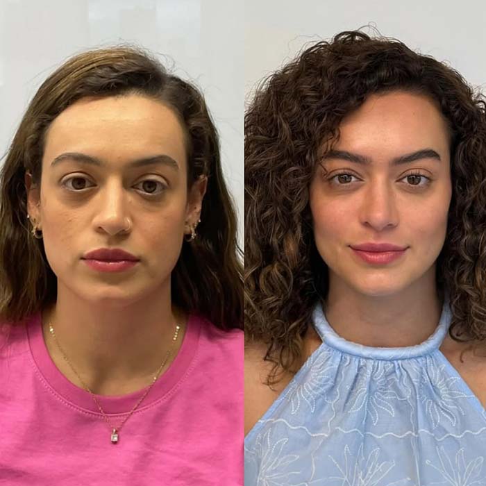 anderson_funari_ resultado11