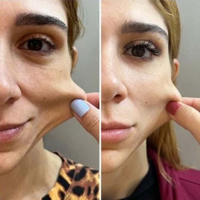 anderson_funari_ resultado8