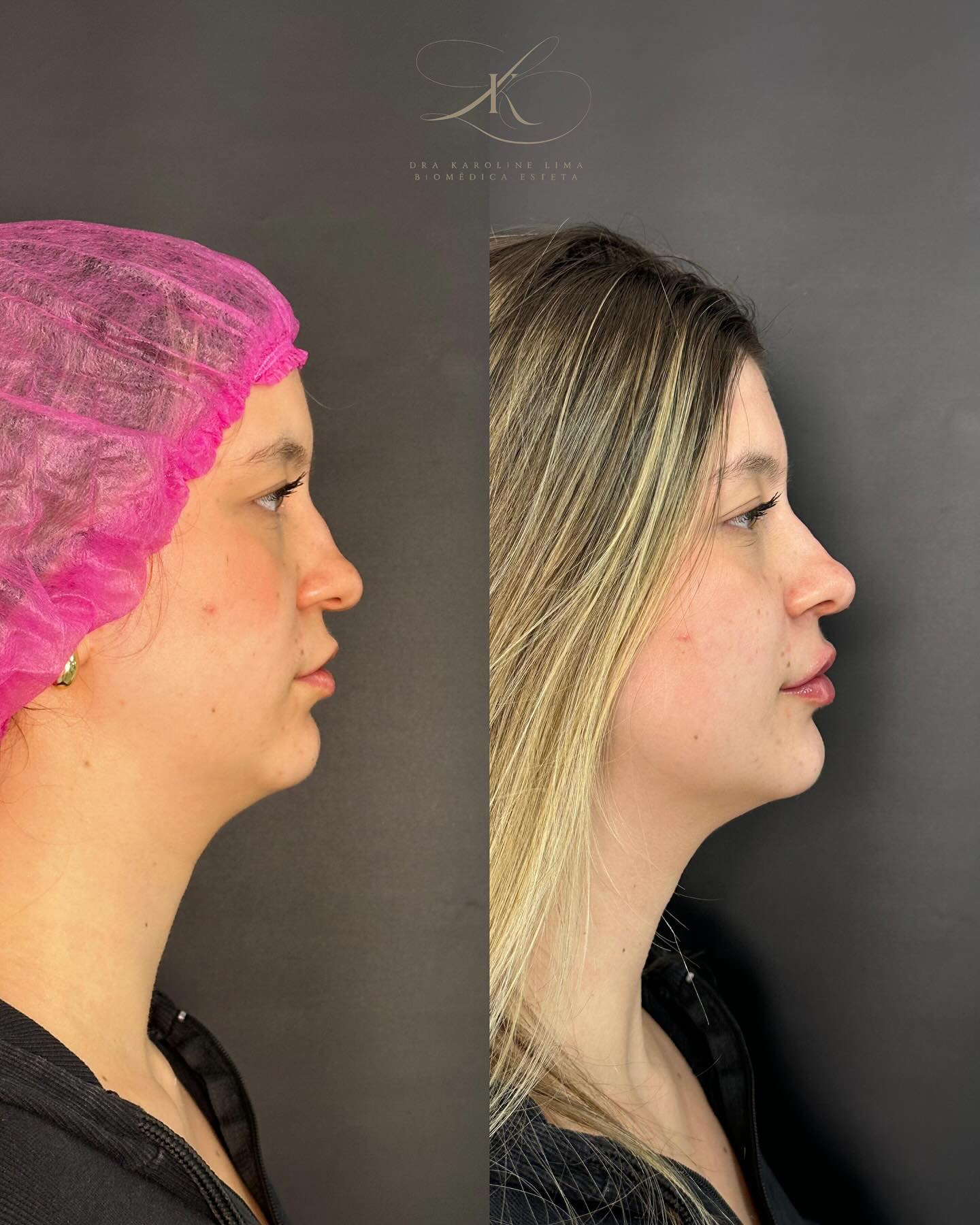 drakarolinelima_1747605601_3635501744467119284_7483432585