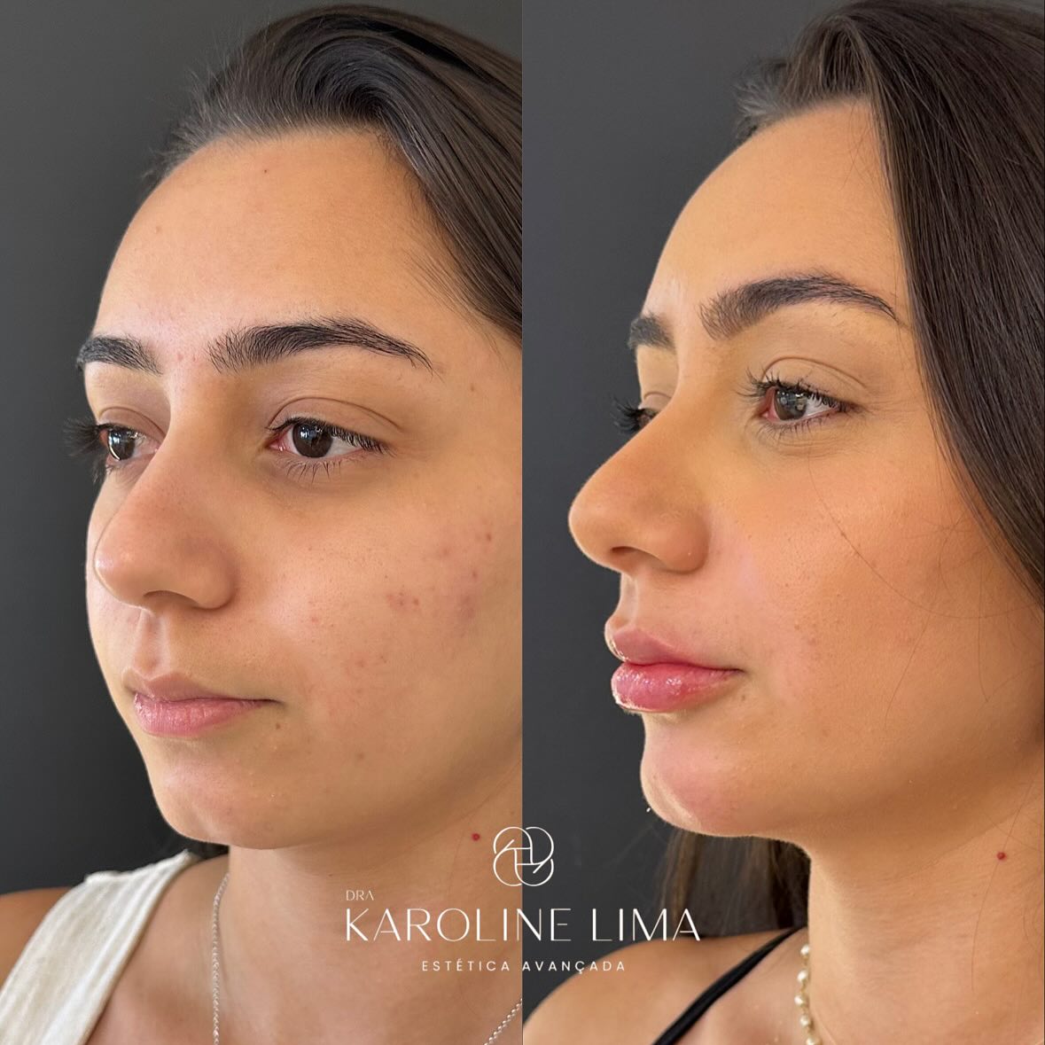 karolima_1752775705_3678871720024296770_44888644