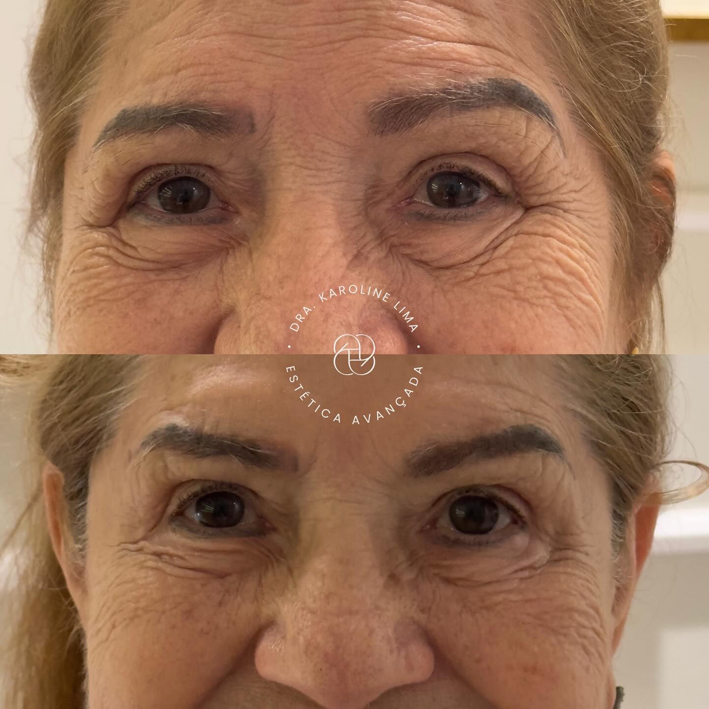 karolima_1762462188_3760127823278184408_44888644