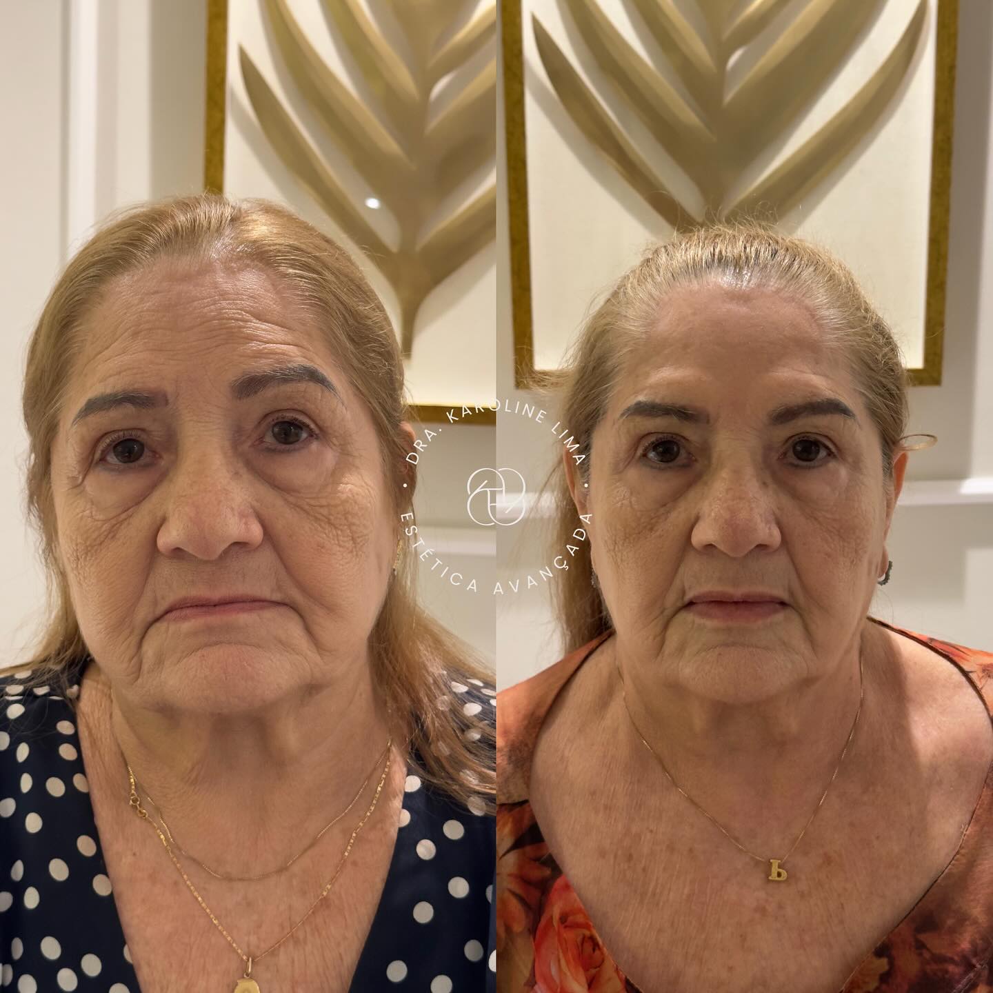 karolima_1762462188_3760127823429237797_44888644