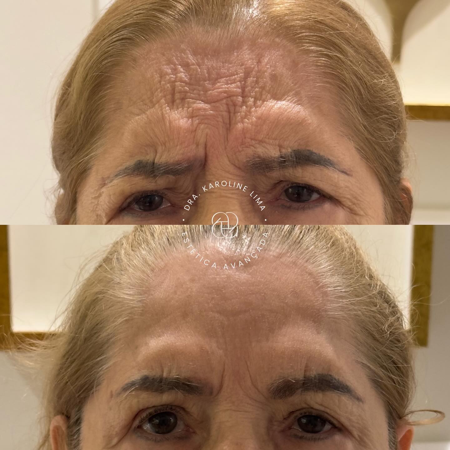 karolima_1762462188_3760127823496298575_44888644