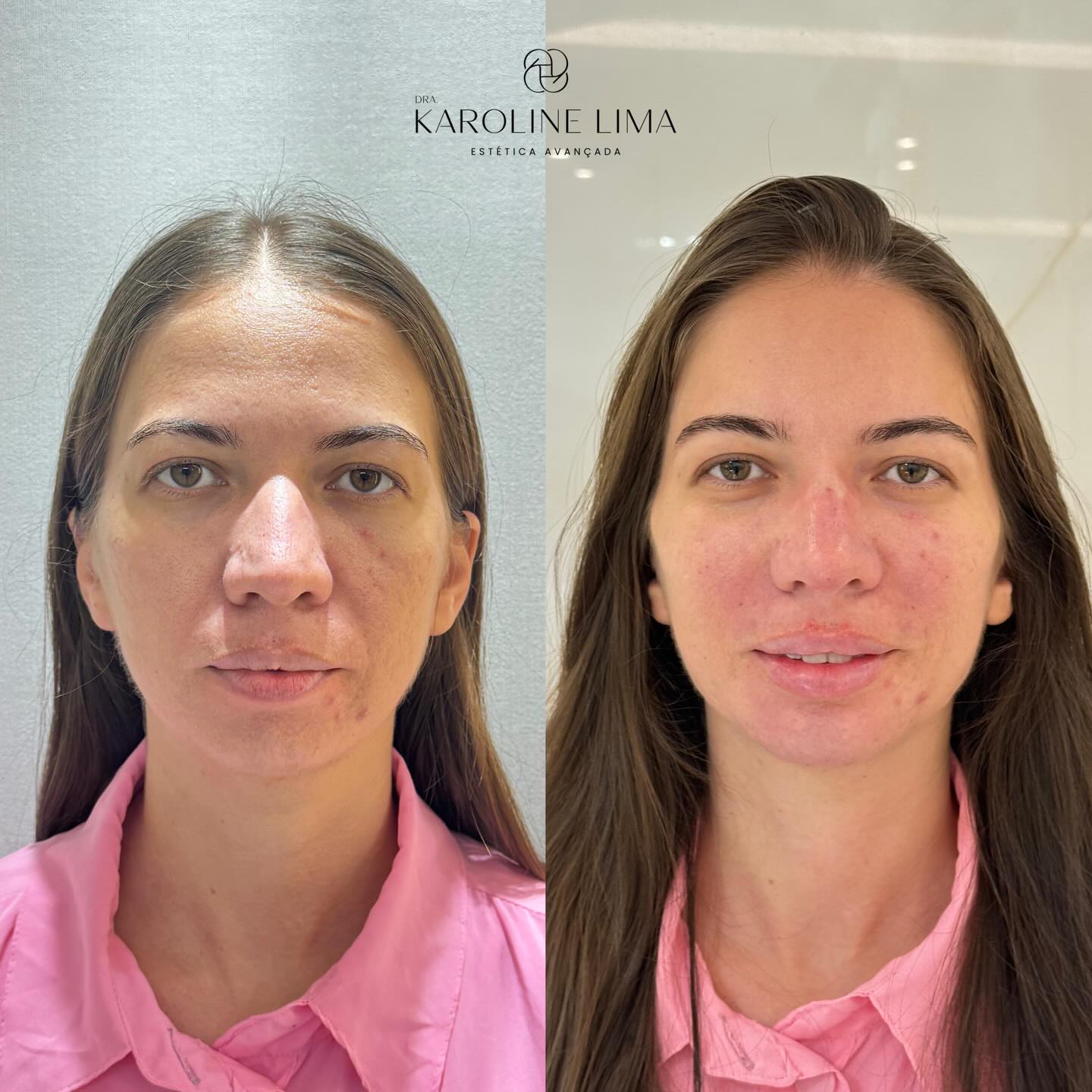 karolima_1765302308_3783952482847118860_44888644