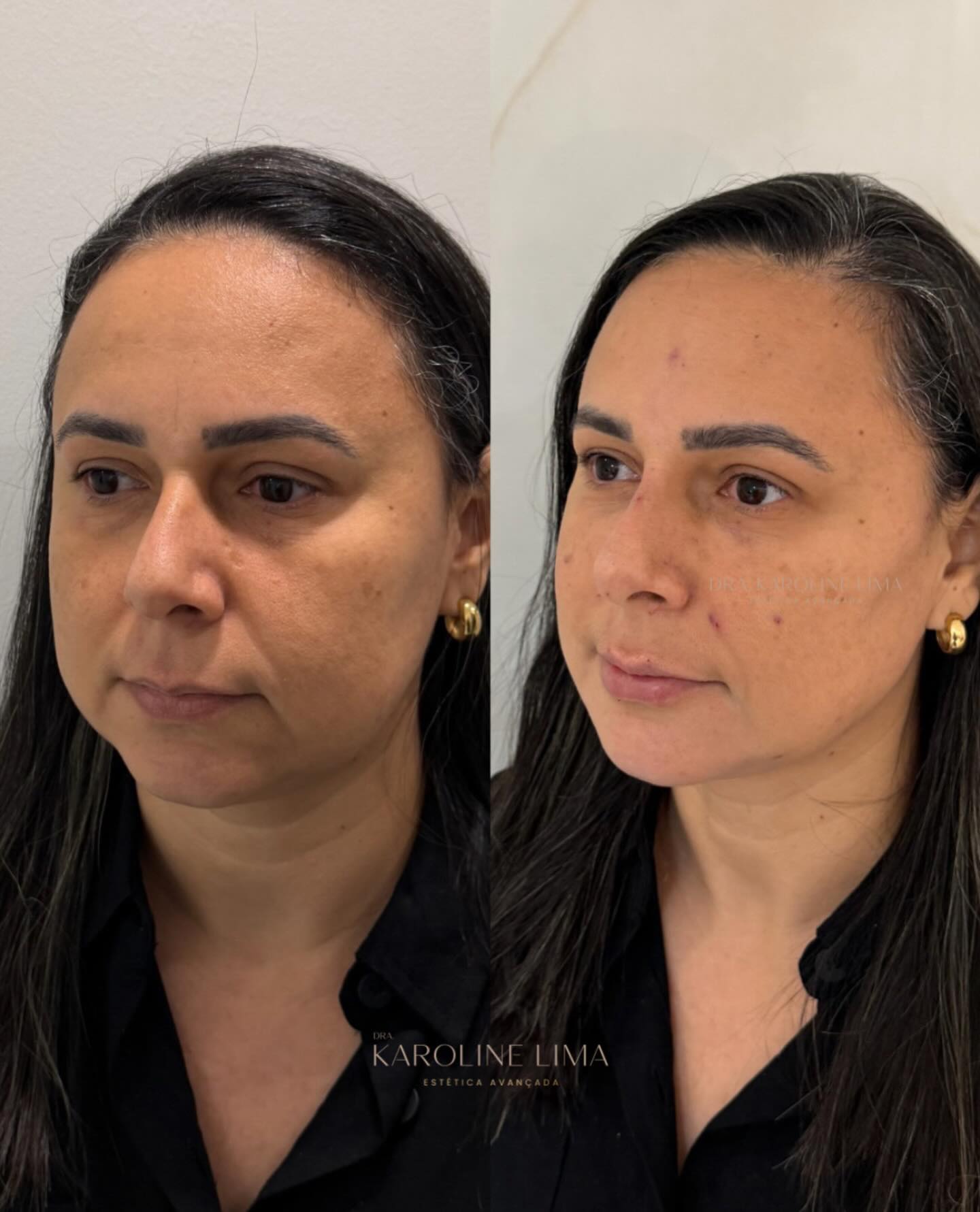 karolima_1770831000_3830330922177043611_44888644